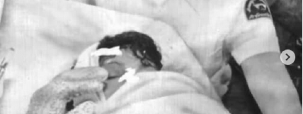 Michael Jackson Pepsi Incident